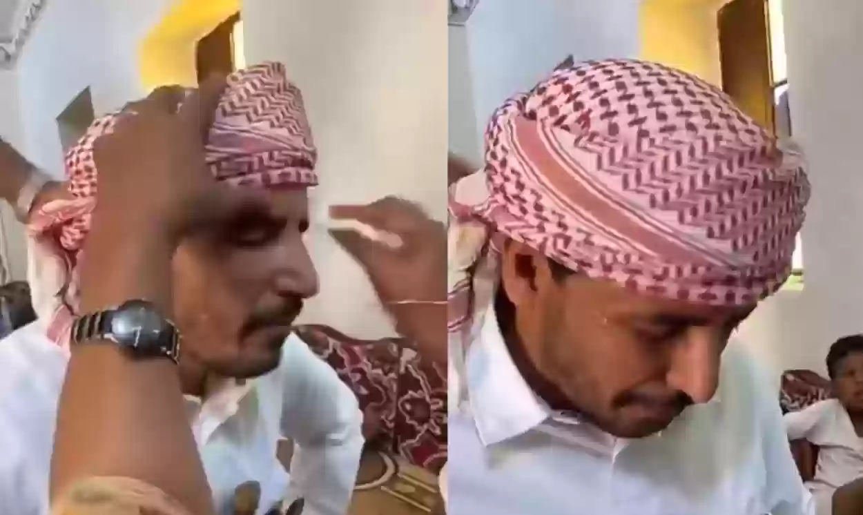  الدكتور فهد الخضيري يكشف حقيقة فيديو إخراج الحجر من عين مريض